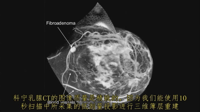 KBCT產(chǎn)品優(yōu)勢4-1