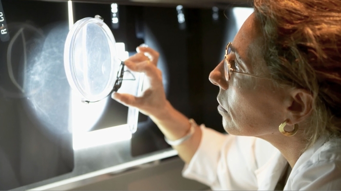 KBCT產(chǎn)品優(yōu)勢9