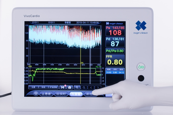血流儲備分?jǐn)?shù)測量設(shè)備圖片