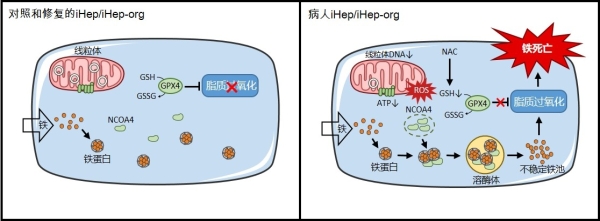線粒體疾病肝細(xì)胞的全新鐵死亡模式、細(xì)胞器互作機(jī)制